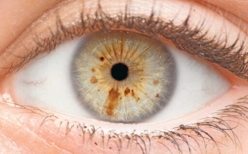 iridologie