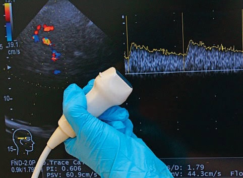 Exploration échographique cardiaque avec doppler couleur pour l'évaluation des fonctions cardiaques et du flux sanguin, illustration des techniques avancées en cardiologie.